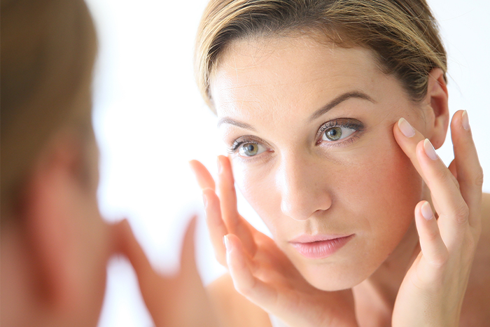 Adult Acne