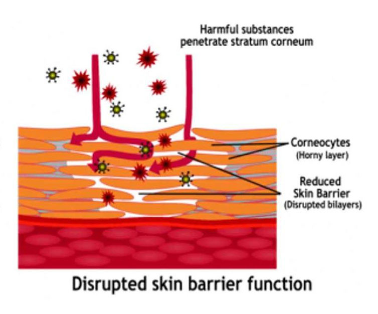 Normal skin barrier function as harmful substances unable to penetrate through the corneocytes and skin barrier