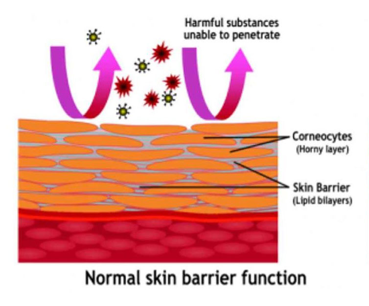 Disrupted skin barrier function as harmful substances penetrate through the stratum corneum