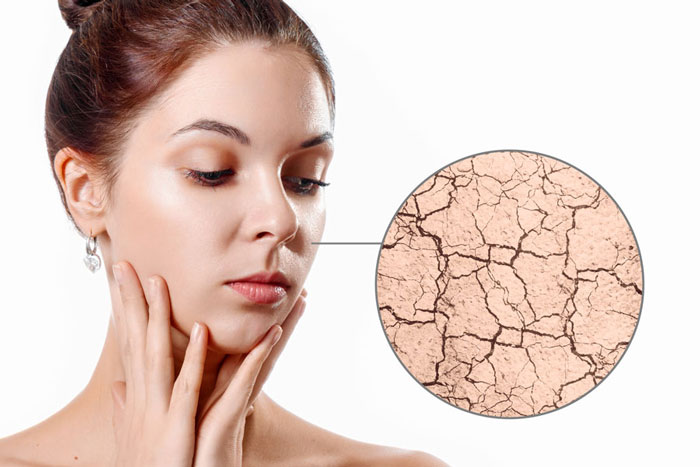 Skin Barrier Function